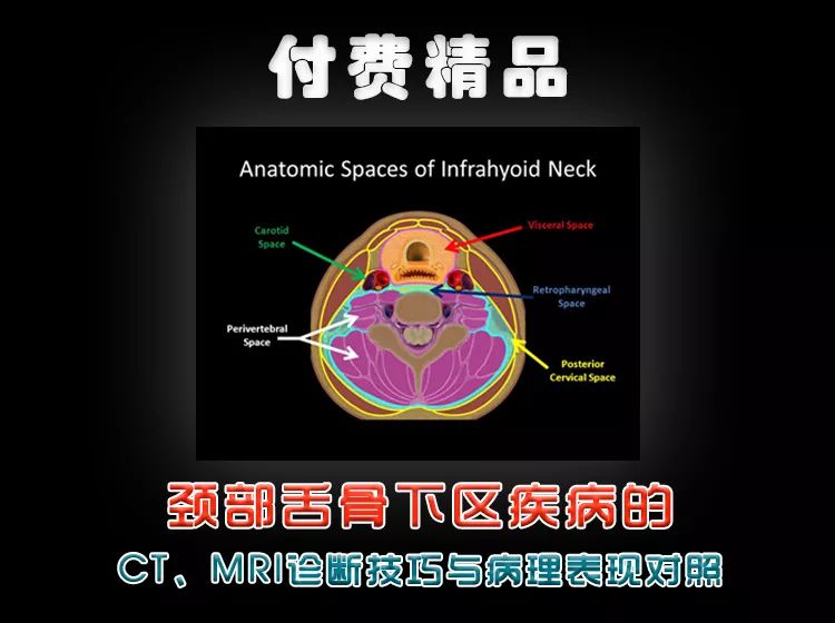 [深度学习] "原发性中枢神经系统血管炎"的临床特点及影像鉴别诊断（建议收藏）~~~