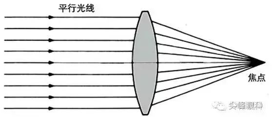 人工晶体——TECNIS® Symfony （新无级）连续视程人工晶体