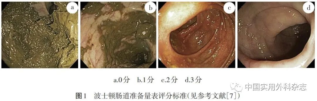 论著｜基于深度学习人工智能在结肠镜检查中应用研究