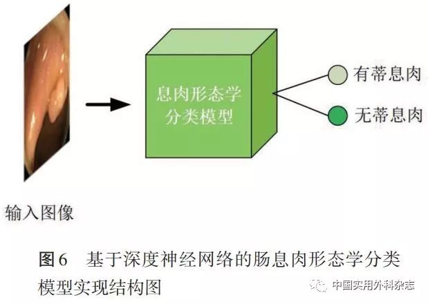 论著｜基于深度学习人工智能在结肠镜检查中应用研究