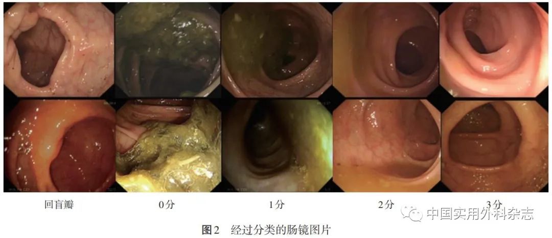 论著｜基于深度学习人工智能在结肠镜检查中应用研究