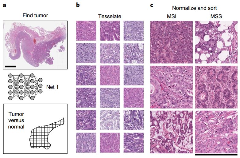 《自然·医学》重磅：人工智能牛大了！深度学习算法竟可直接从病理切片识别基因组不稳定，或可指导免疫治疗 | 科学大发现