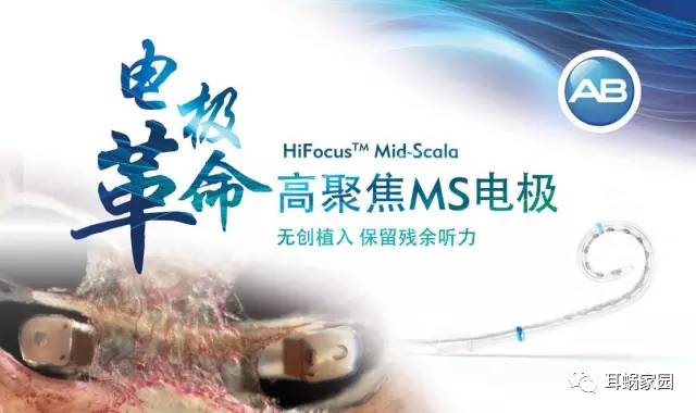 美国AB耳蜗HiFocus Mid-Scala MS电极详解