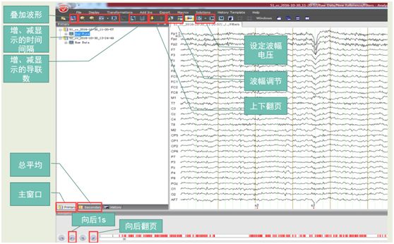 手把手带你入门—Analyzer ERP数据处理