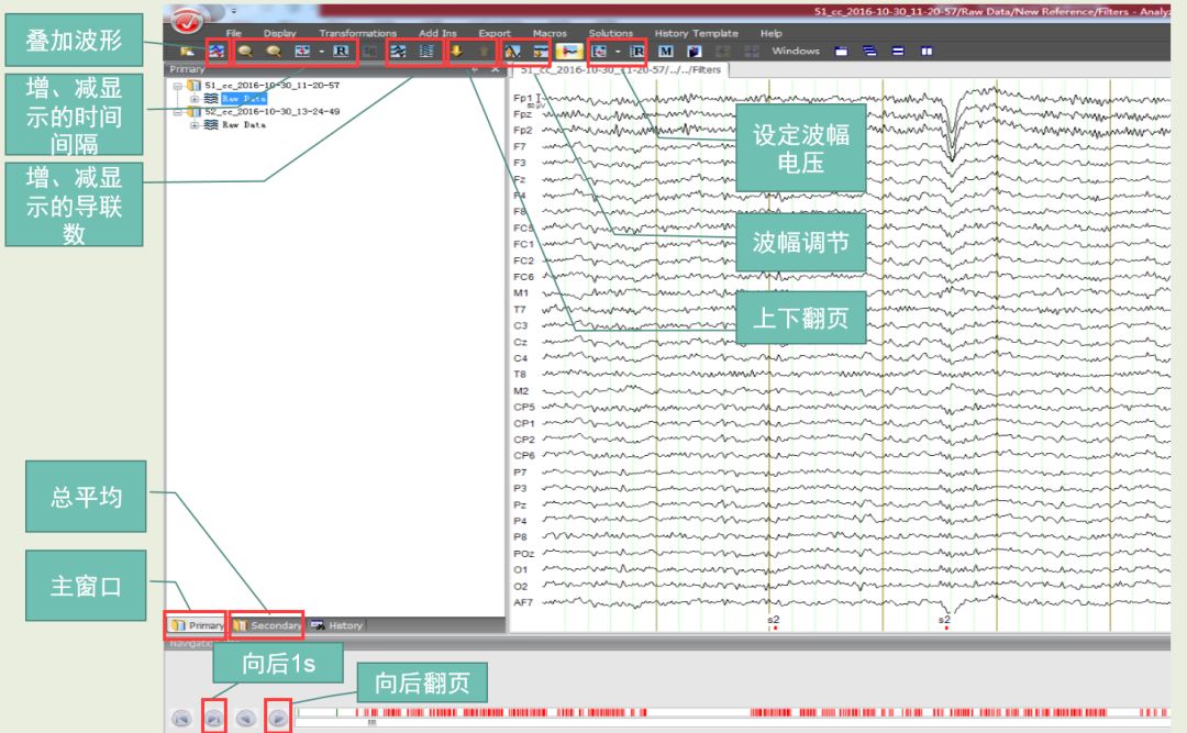 Analyzer脑电数据处理指导手册