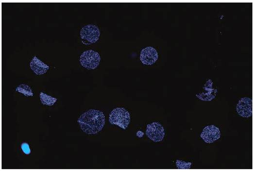 IN Cell Analyzer应用秘籍系列——第一式