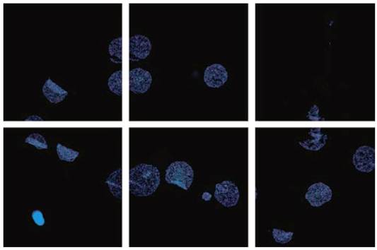 IN Cell Analyzer应用秘籍系列——第一式