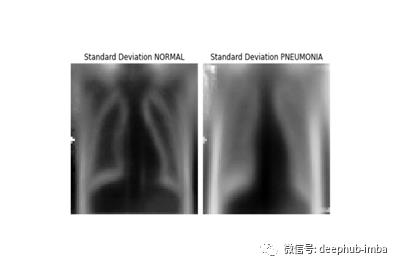 使用卷积神经网络构建图像分类模型检测肺炎