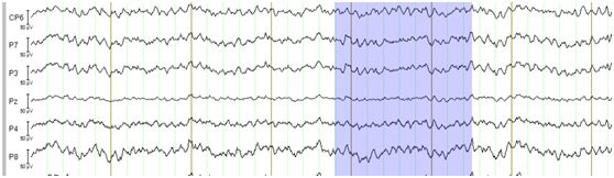 手把手带你入门—Analyzer ERP数据处理