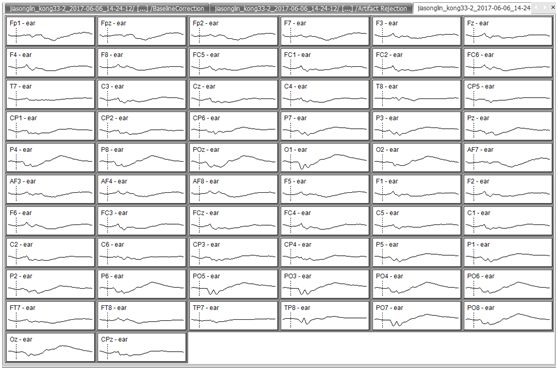 手把手带你入门—Analyzer ERP数据处理