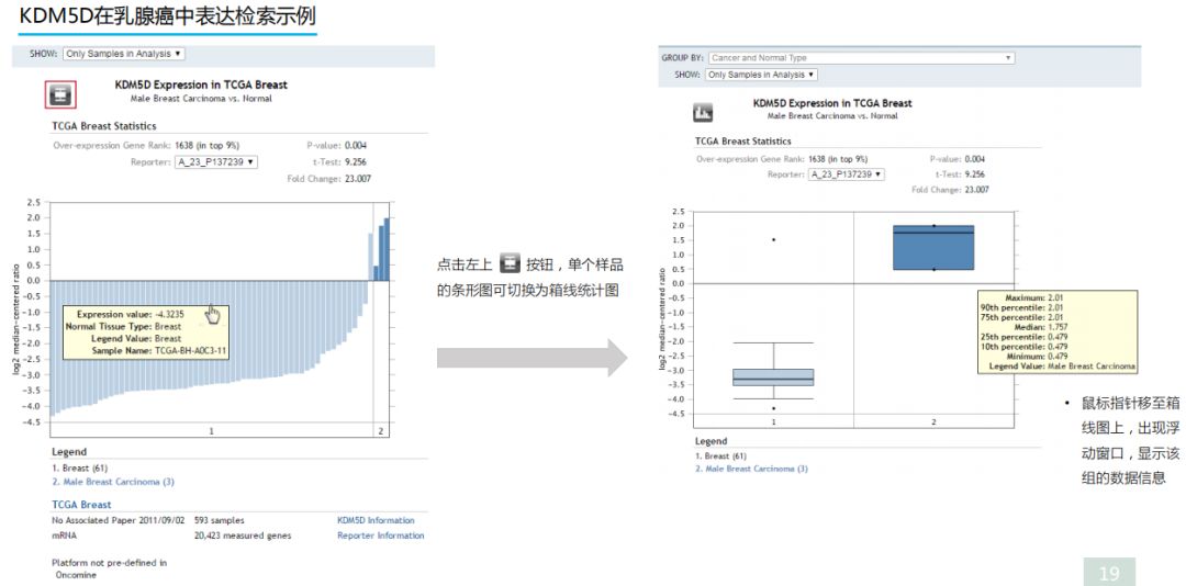学好Oncomine，触摸肿瘤数据挖掘