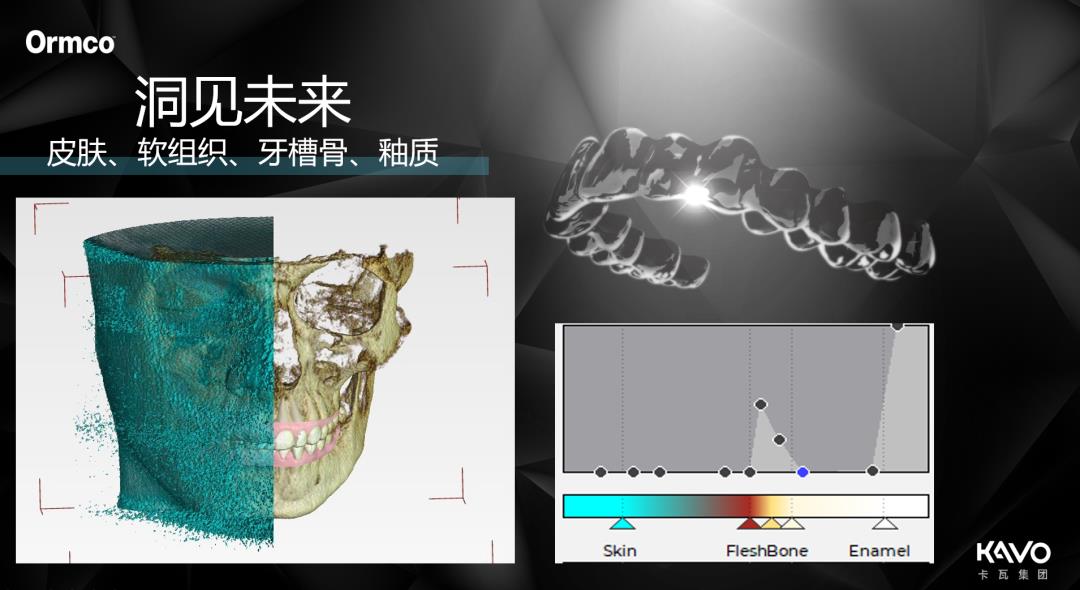 隐形新势力 牙根黑科技 | SPARK®精靓®邂逅CBCT