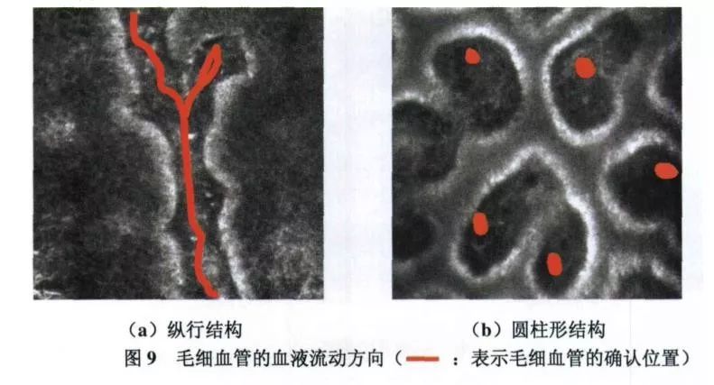 被亲妈坑？Talor Swift未经允许曝光的真素颜震撼我全家...