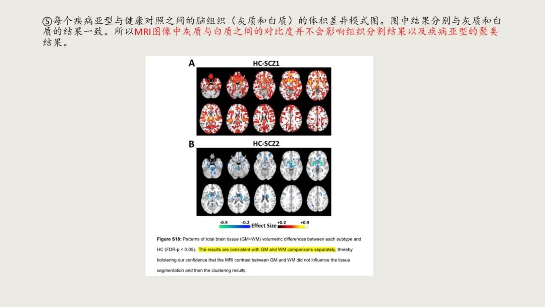 利用机器学习方法揭示两种精神分裂症亚型