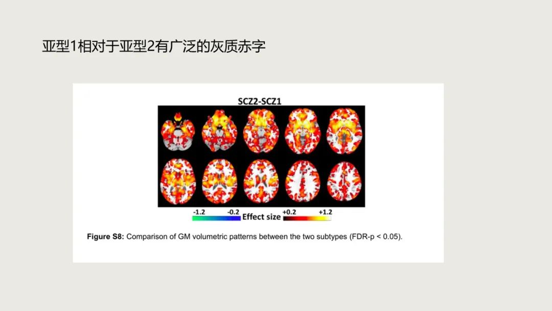 利用机器学习方法揭示两种精神分裂症亚型