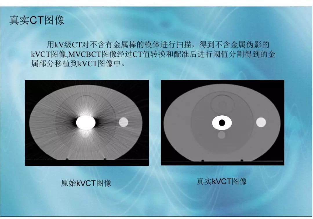 【分享】运用 MVCBCT 去除 KVCT 图像中的金属伪影