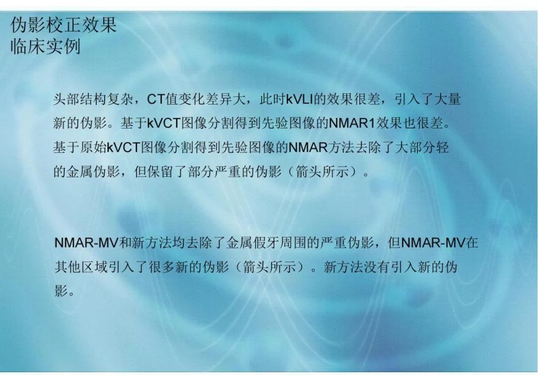 【分享】运用 MVCBCT 去除 KVCT 图像中的金属伪影