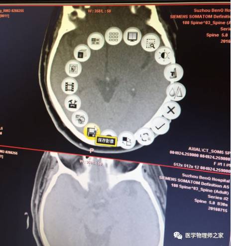 如何将医院HIS系统CT图像导入Eclipse电脑