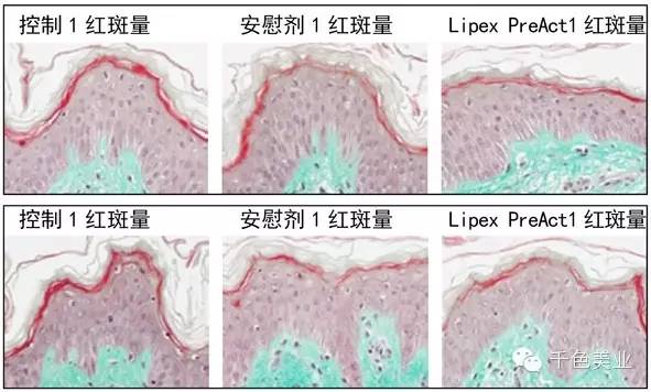 【原料】Lipex® PreAct活性润肤剂增强对皮肤的保护