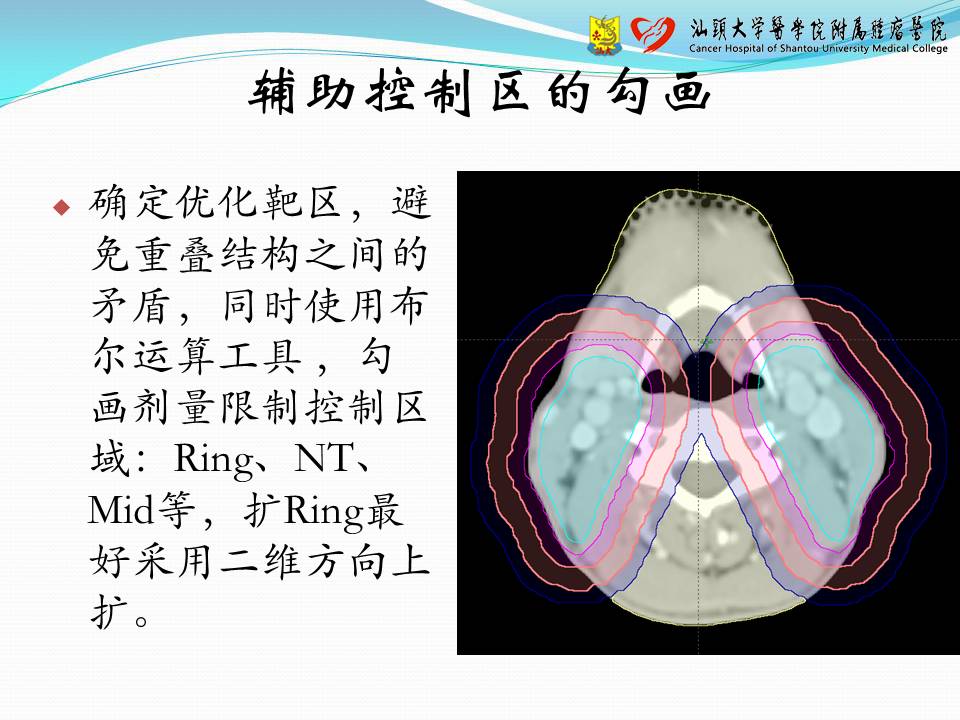 基于 Eclipse 计划系统的容积调强计划设计——经验交流