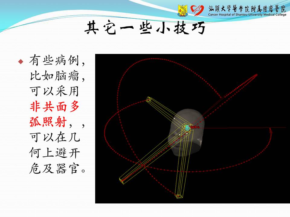 基于 Eclipse 计划系统的容积调强计划设计——经验交流