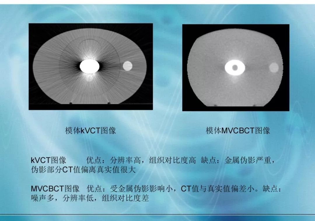 【分享】运用 MVCBCT 去除 KVCT 图像中的金属伪影