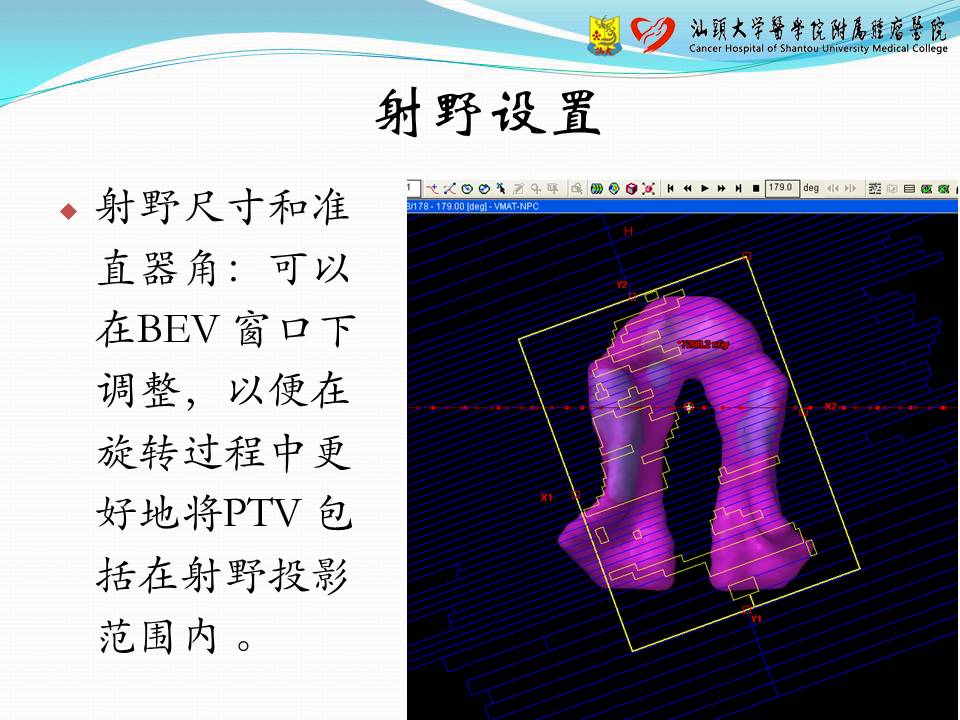 基于 Eclipse 计划系统的容积调强计划设计——经验交流