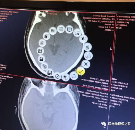 如何将医院HIS系统CT图像导入Eclipse电脑