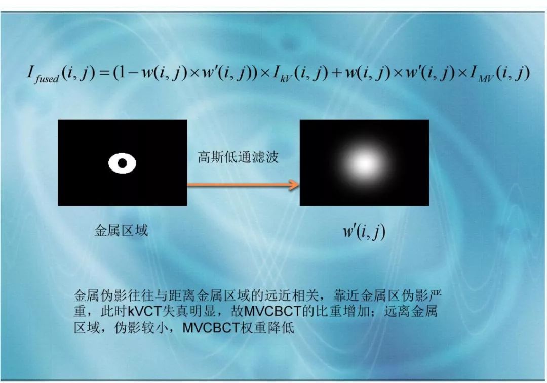 【分享】运用 MVCBCT 去除 KVCT 图像中的金属伪影