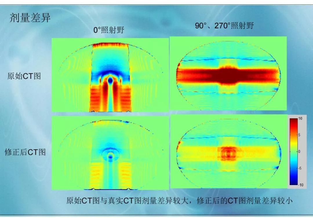 【分享】运用 MVCBCT 去除 KVCT 图像中的金属伪影