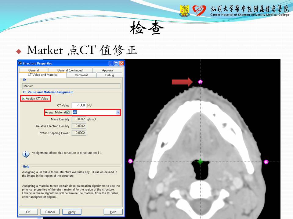 基于 Eclipse 计划系统的容积调强计划设计——经验交流