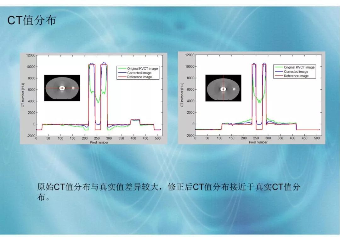 【分享】运用 MVCBCT 去除 KVCT 图像中的金属伪影