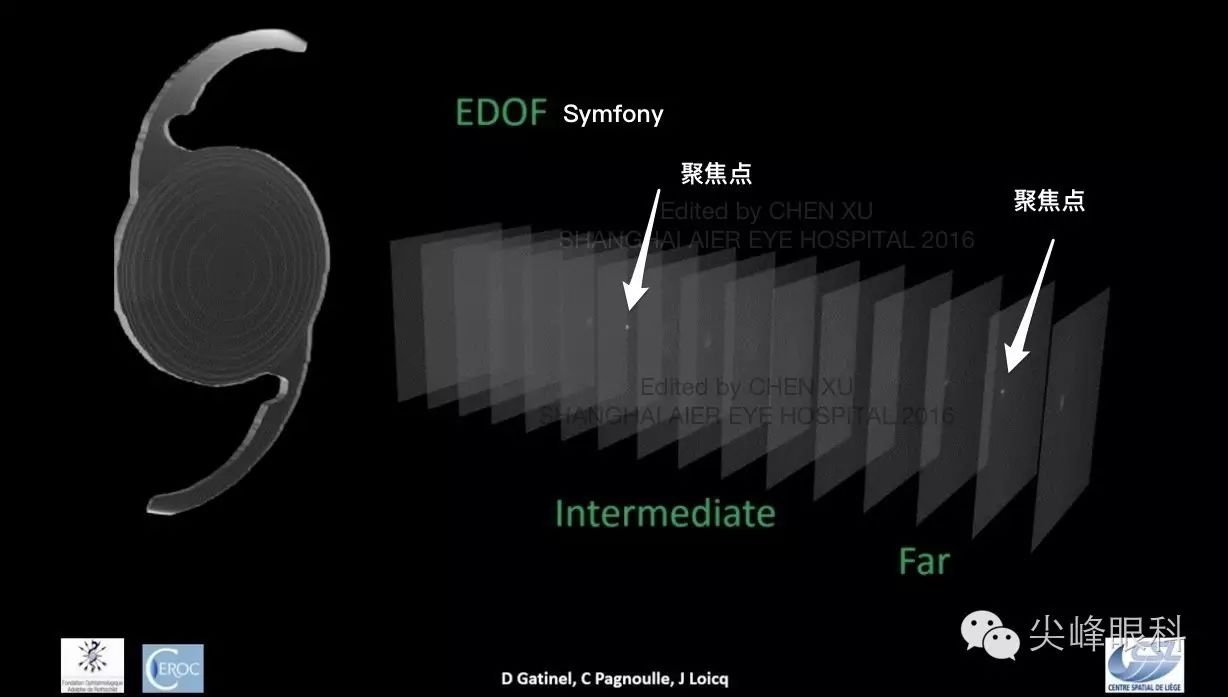 尖峰眼科 | 也谈Symfony新无极人工晶体（下）：纸上谈兵之临床效果比较篇