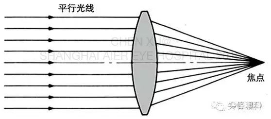 尖峰眼科 | 也谈Symfony新无极人工晶体（上） 陈旭