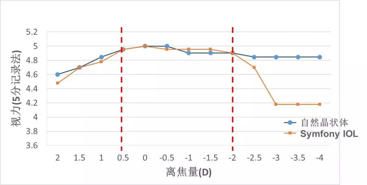 新无级，悦无界——Symfony®IOL临床使用经验分享