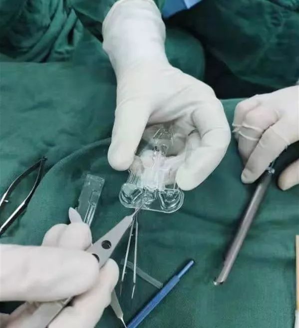 淮安市二院专家成功开展淮安首例TECNIS Symfony人工晶体植入术，让患者恢复清晰视力！