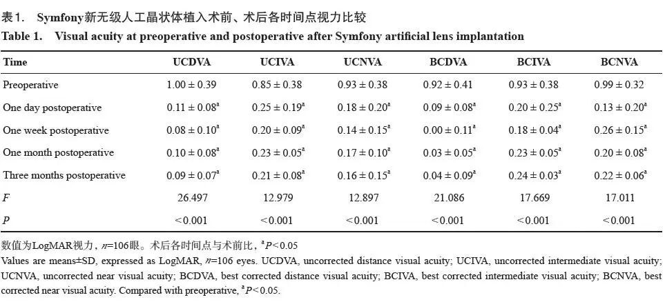 Symfony新无级人工晶状体的临床应用