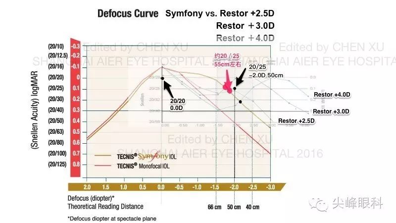 尖峰眼科 | 也谈Symfony新无极人工晶体（下）：纸上谈兵之临床效果比较篇