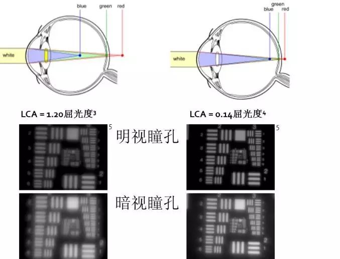 新无级，悦无界——TECNIS Symfony®（新无级）晶英沙龙