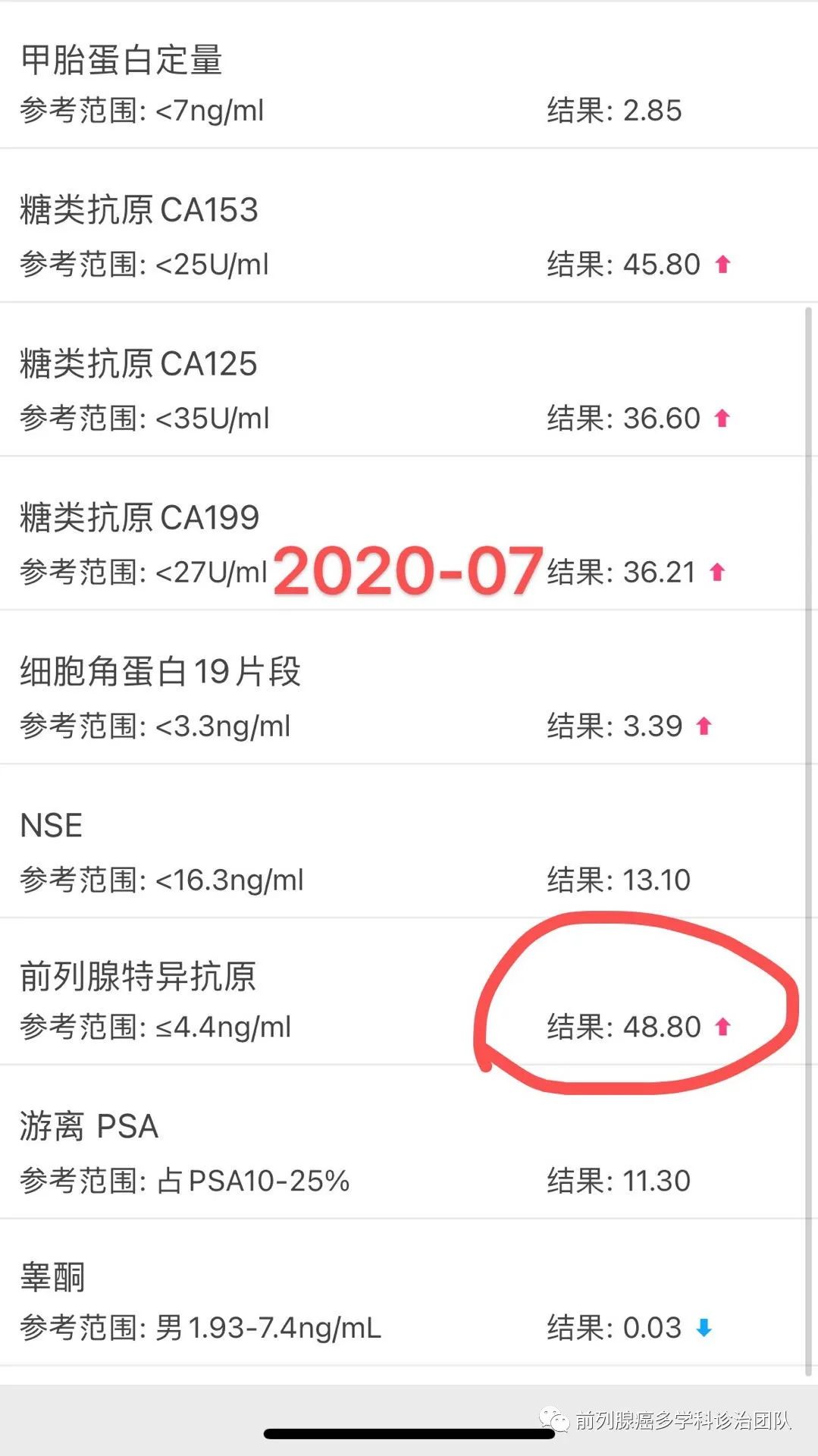 病例分享：一例肝转移mCRPC的精准治疗后完全缓解(10个月随访)