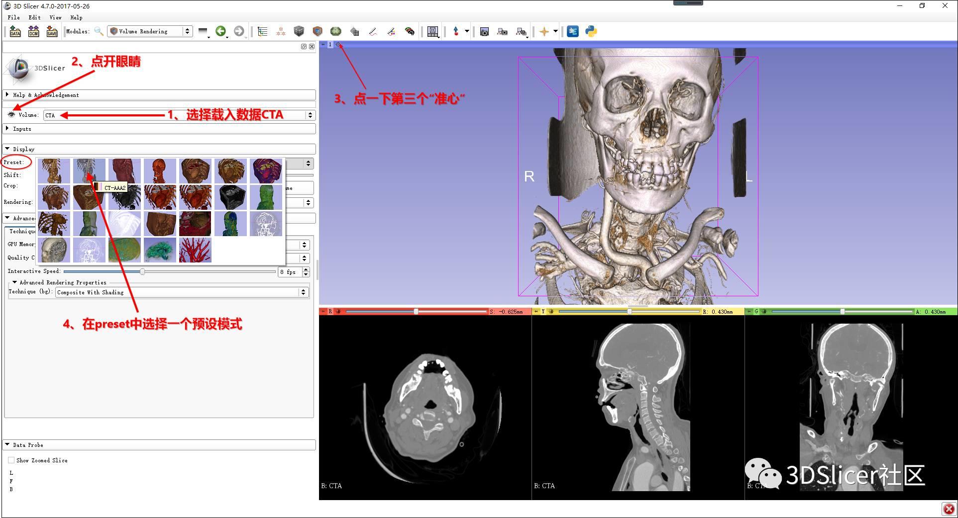 3DSlicer入门解惑篇——你想知道的都在这里