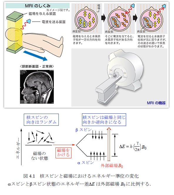 MRI的原理