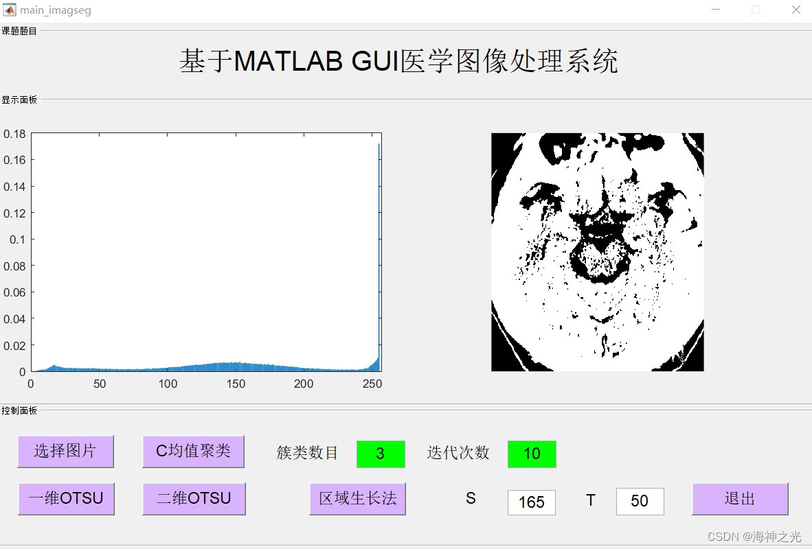 【图像分割】基于matlab