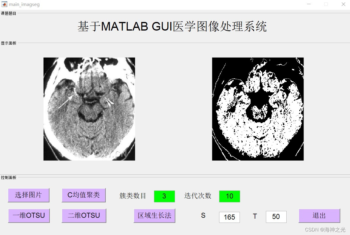 【图像分割】基于matlab