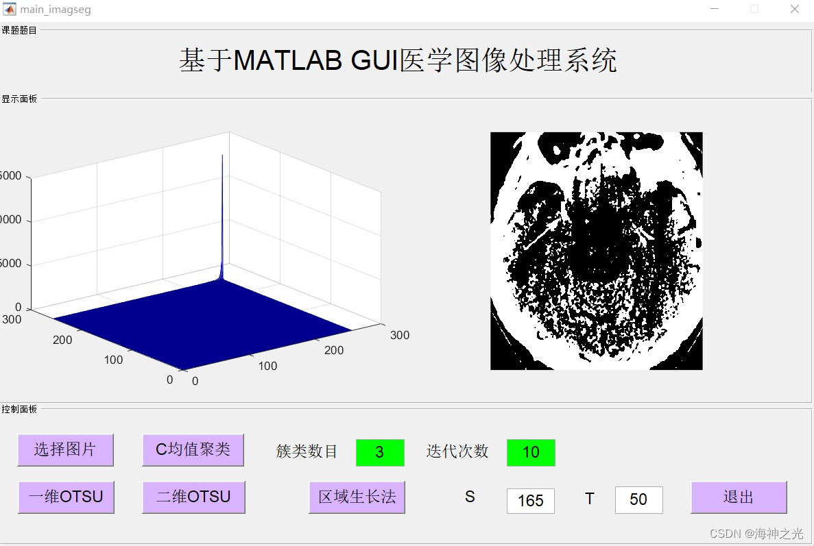 【图像分割】基于matlab