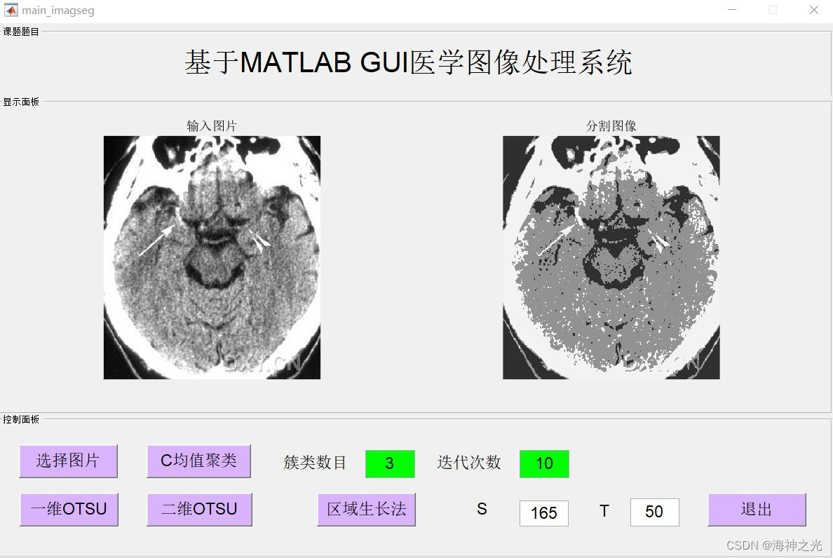 【图像分割】基于matlab